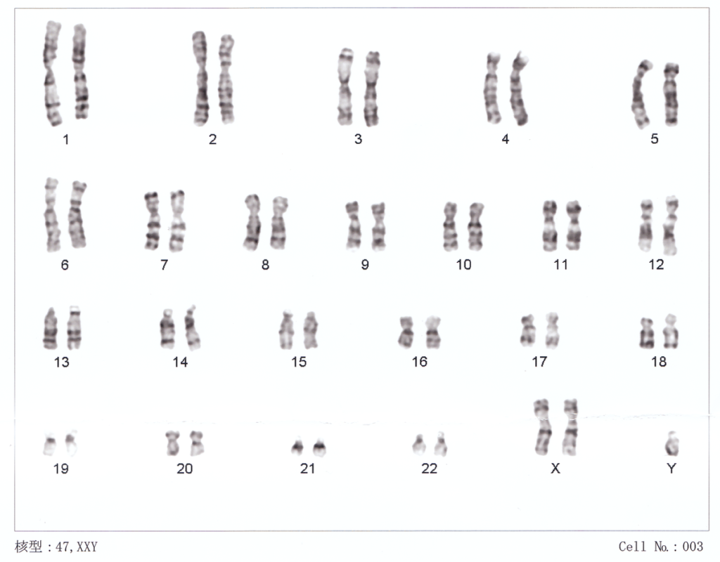 XXXX Chromosomes