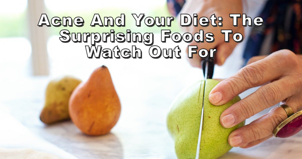 Acne and Your Diet The Surprising Foods to Watch Out For