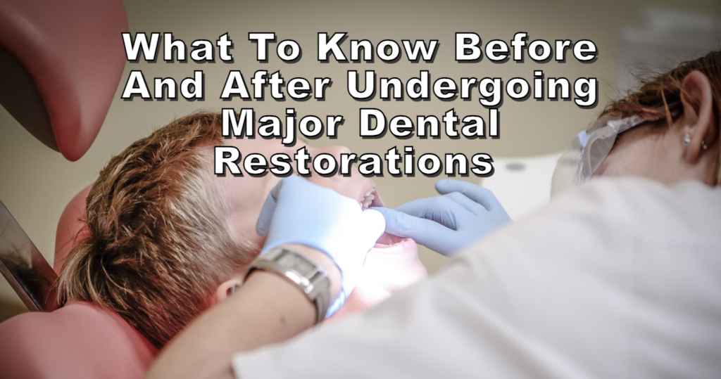 What to Know Before and After Undergoing Major Dental Restorations 